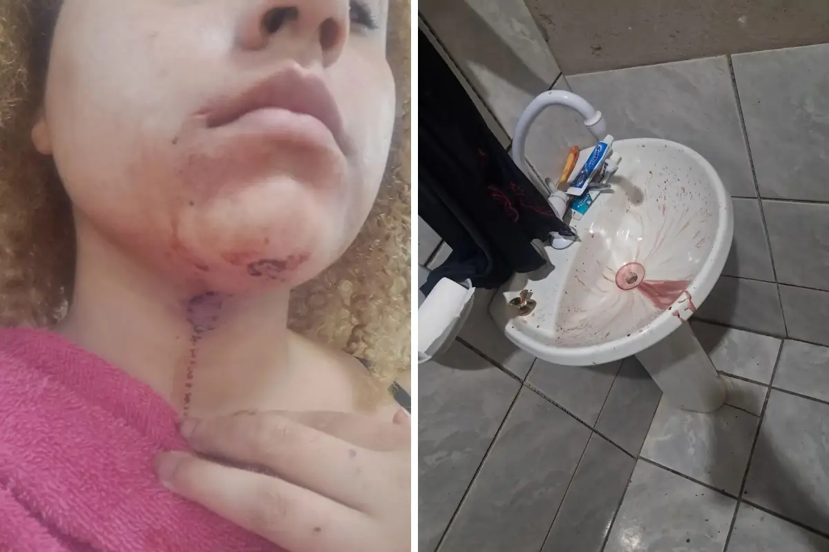 estudante direito violencia policial