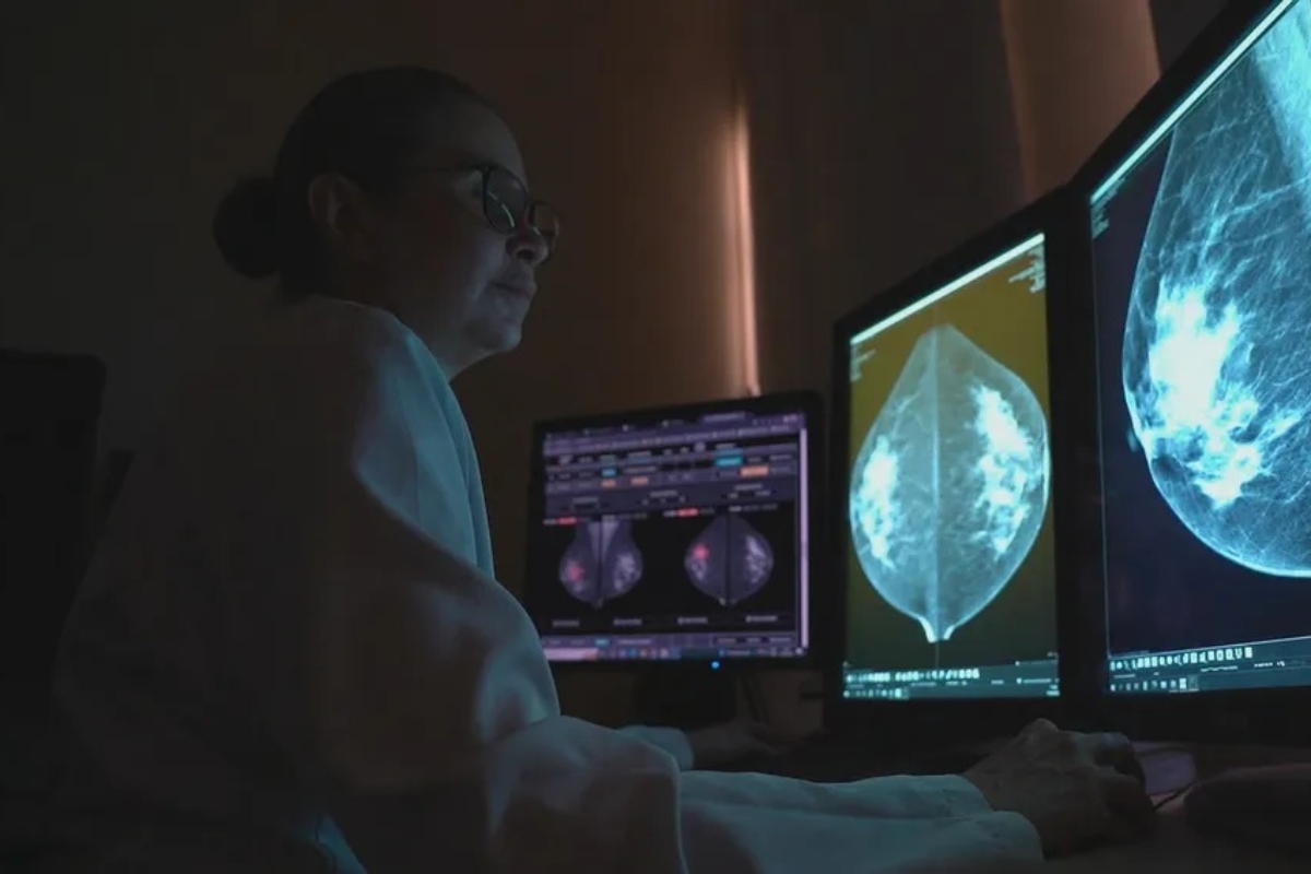 Médica examinando ultrassom de mama