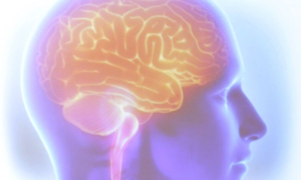 Epilepsia
